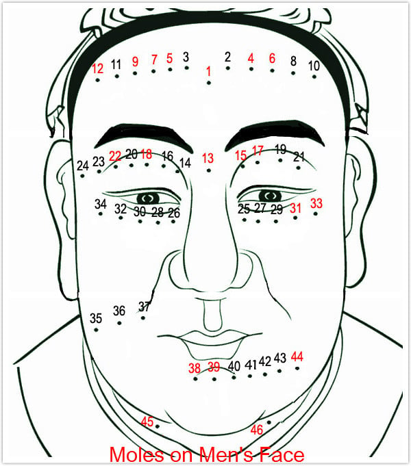 Moles on Men's Face