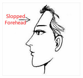 Forehead Face Reading: Shapes, Types of Hairlines, Lines, Wrinkles