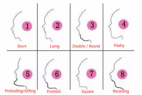 types of chin