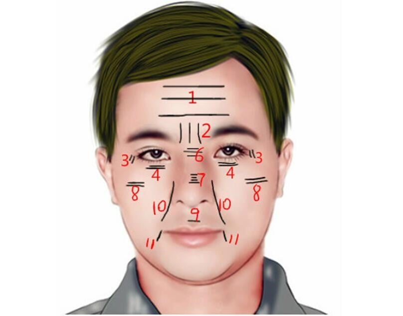 Facial Lines and Wrinkles Face Reading Crow'sfeet, Lines on Forehead